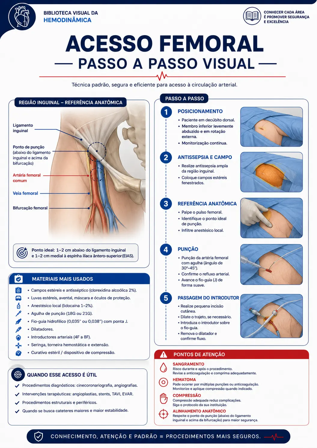 Acesso femoral — passo a passo visual