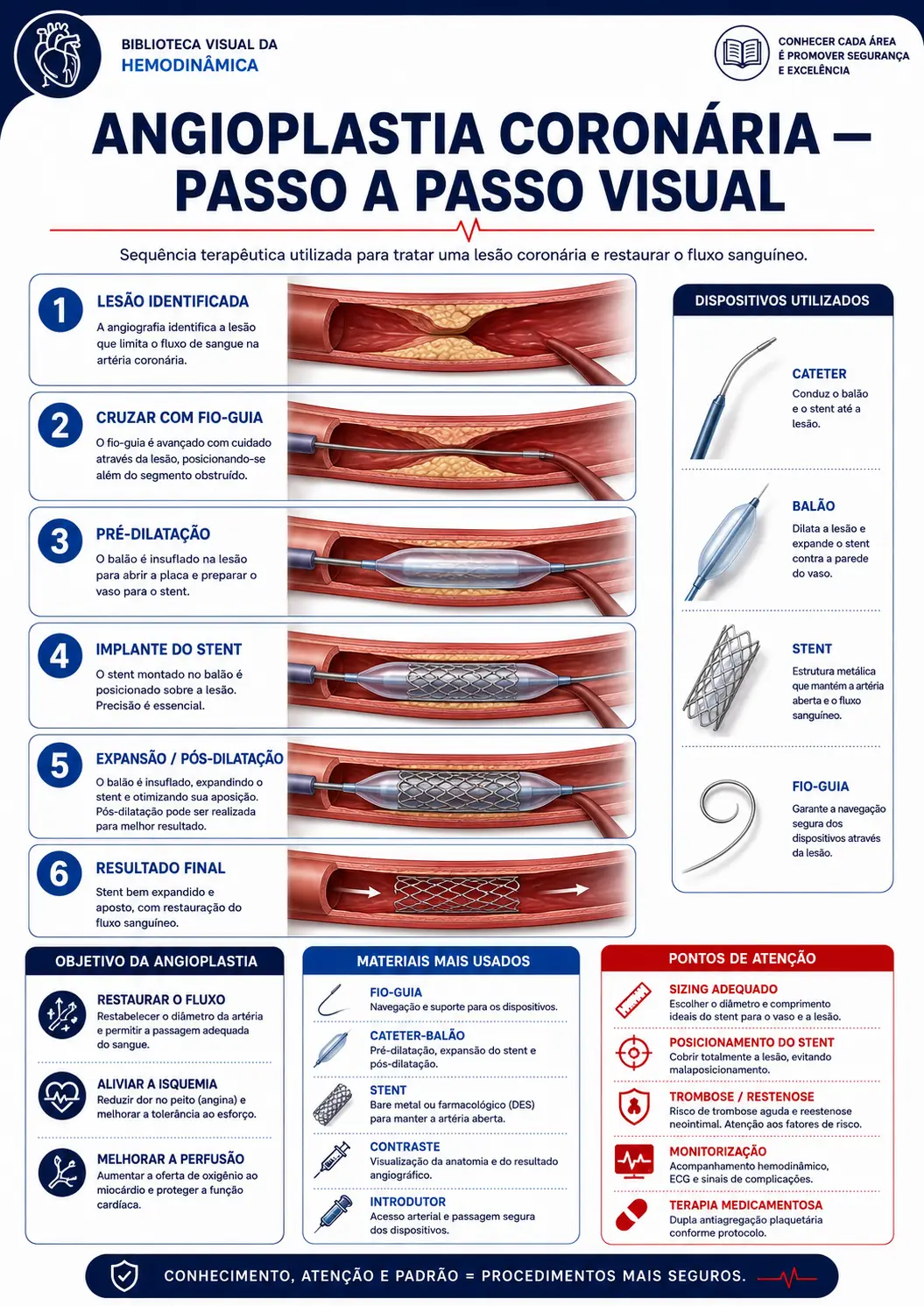 Angioplastia coronária — passo a passo visual