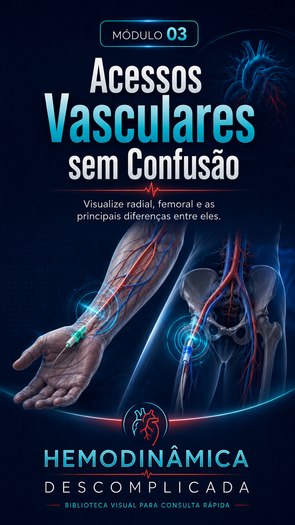 Módulo 03 — Acessos Vasculares sem Confusão