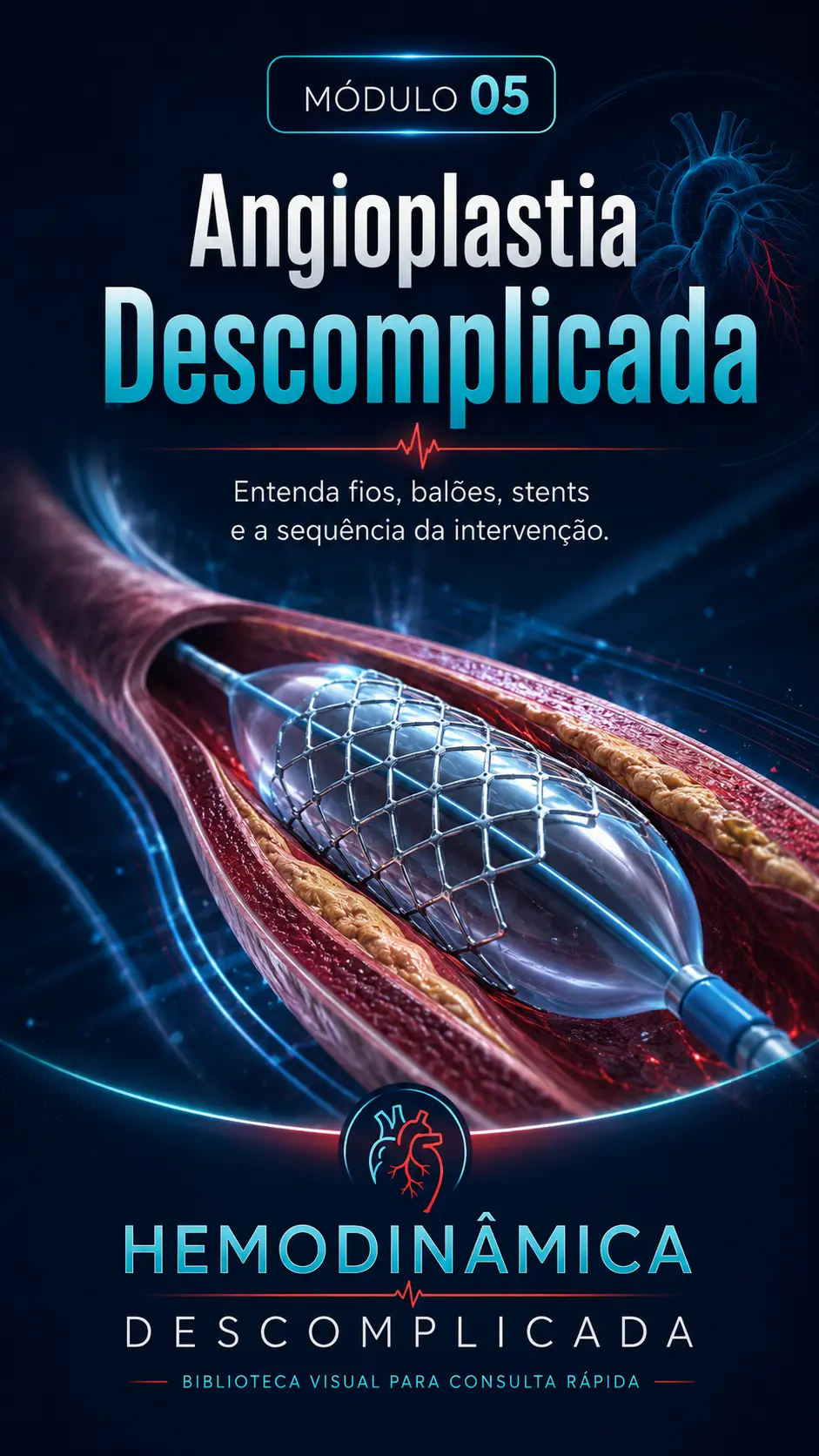 Módulo 05 — Angioplastia Descomplicada